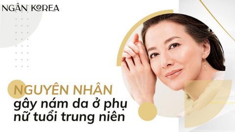 Nám da tuổi 40 và kem trị nám cho tuổi 40 mà bạn nên biết?