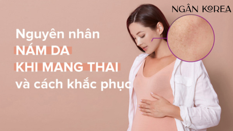 Nám da khi mang thai và cách khắc phục
