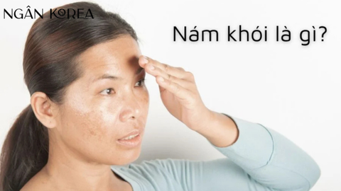 Nám khói là gì? Cách điều trị nám khói hiệu quả nhất
