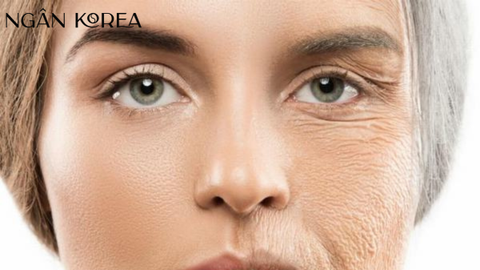 Lão hóa da là gì? Cách chống lão hóa hiệu quả mà bạn nên biết?